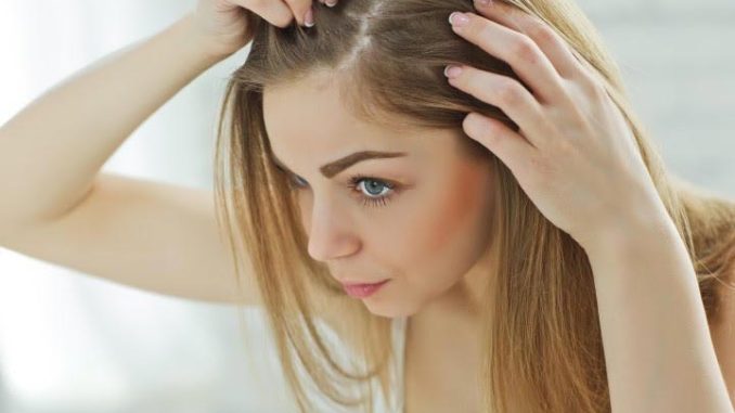 घरेलु नुस्खों से दूर करें गंजापन